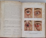 MAY Charles Henry "Manuel des Maladies de l'Oeil à l'usage des étudiants et des praticiens"