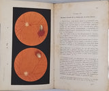 HAAB Otto [Dr. TERSON Albert, Dr. CUÉNOD Auguste - Traducteurs] "Atlas manuel d'Ophtalmoscopie"