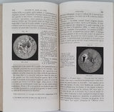 DESMARRES Louis Auguste "Traité Théorique et Pratique des Maladies des Yeux"