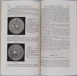 DESMARRES Louis Auguste "Traité Théorique et Pratique des Maladies des Yeux"