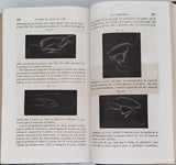 DESMARRES Louis Auguste "Traité Théorique et Pratique des Maladies des Yeux"