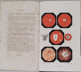 FOLLIN François Anthyme Eugène "Leçons sur l'Exploration de l'Oeil et en particulier sur les applications de l'Ophthalmoscope au diagnostic des maladies des yeux"