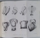 HUGUIER Pierre-Charles "De l'Hystérométrie et du cathétérisme utérin de leurs applications au diagnostic et au traitement des maladies de l'utérus et de ses annexes et de leur emploi en obstétrique"