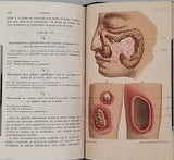 JOZAN Emile (Père) et JOZAN Georges (Fils) "Traité Pratique des Maladies des Voies urinaires et des Organes générateurs de l'Homme - Spécialement dédié aux Gens du monde"