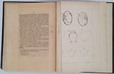 HERRGOTT François [Thèse de Médecine] "Essai sur les différentes variétés de forme de la matrice, pendant la gestation et l'accouchement, suivi de la solution de quatre questions proposées pour la réception au Doctorat"