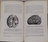 HARTMANN Robert "Les Singes anthropoïdes et leur organisation comparée à celle de l'Homme"